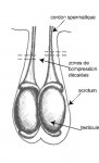 Technique castration pince